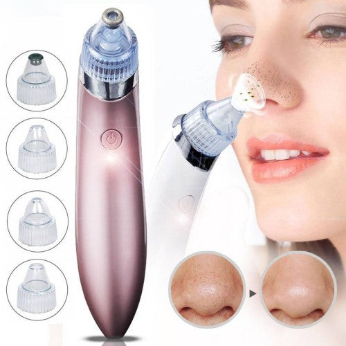 5-in-1 Blackhead Vacuum Pore Cleaner & Acne Remover